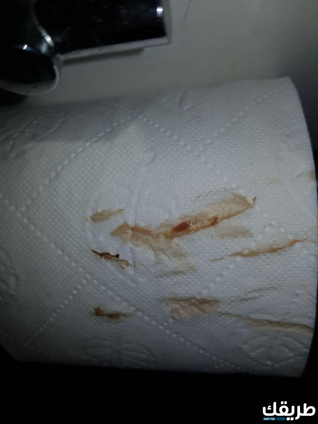 بحث عن اليوم العالمي للماء بالفرنسية 6 افرازات بنية