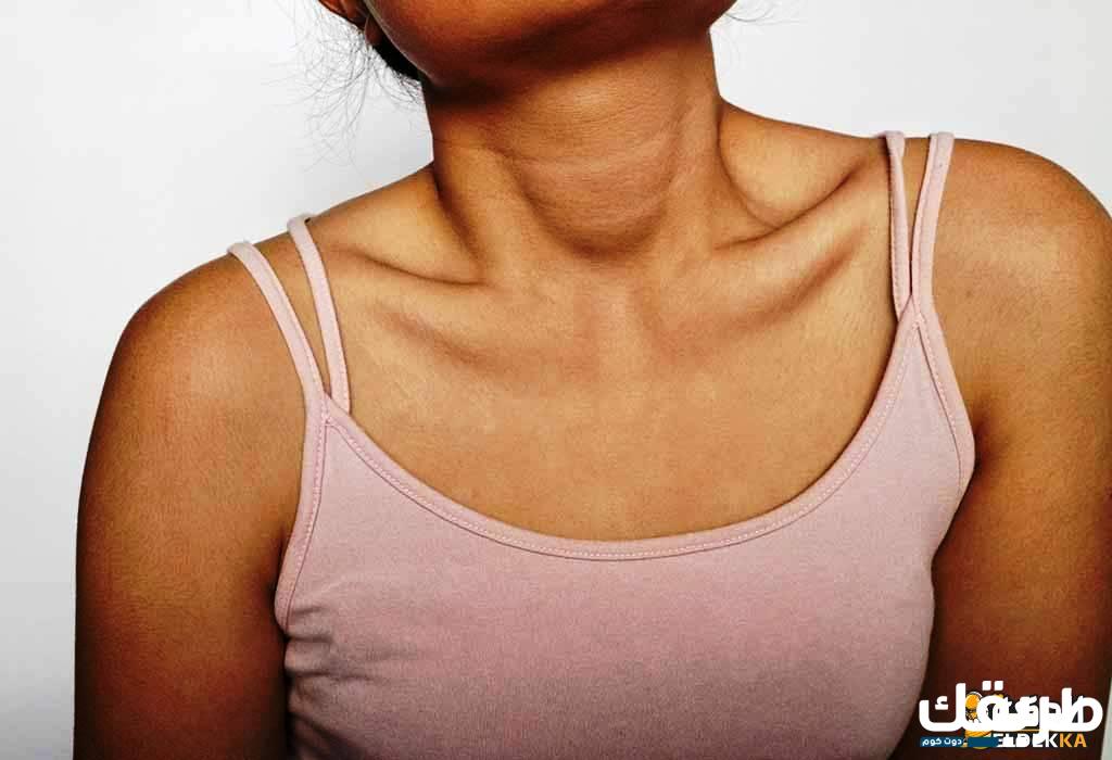 ما هى أسباب كلف الرقبة أثناء الحمل 4 كلف الرقبة أثناء الحمل