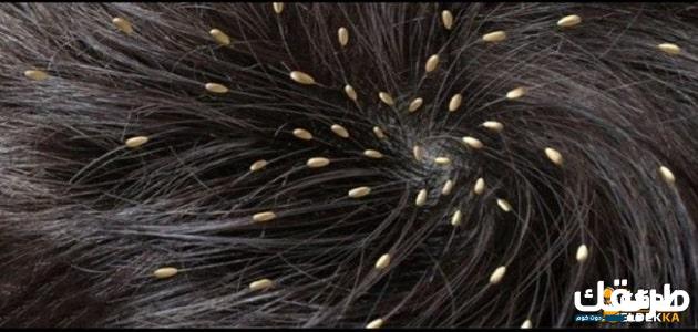 رؤية القمل في المنام لابن سيرين 2 رؤية القمل في المنام