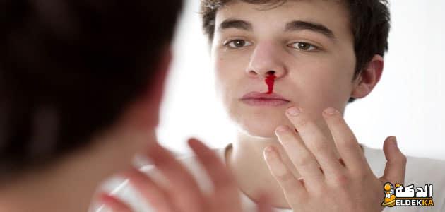 تفسير حلم خروج الدم من الانف في المنام لابن سيرين 5 ما تفسير حلم خروج الدم من الانف