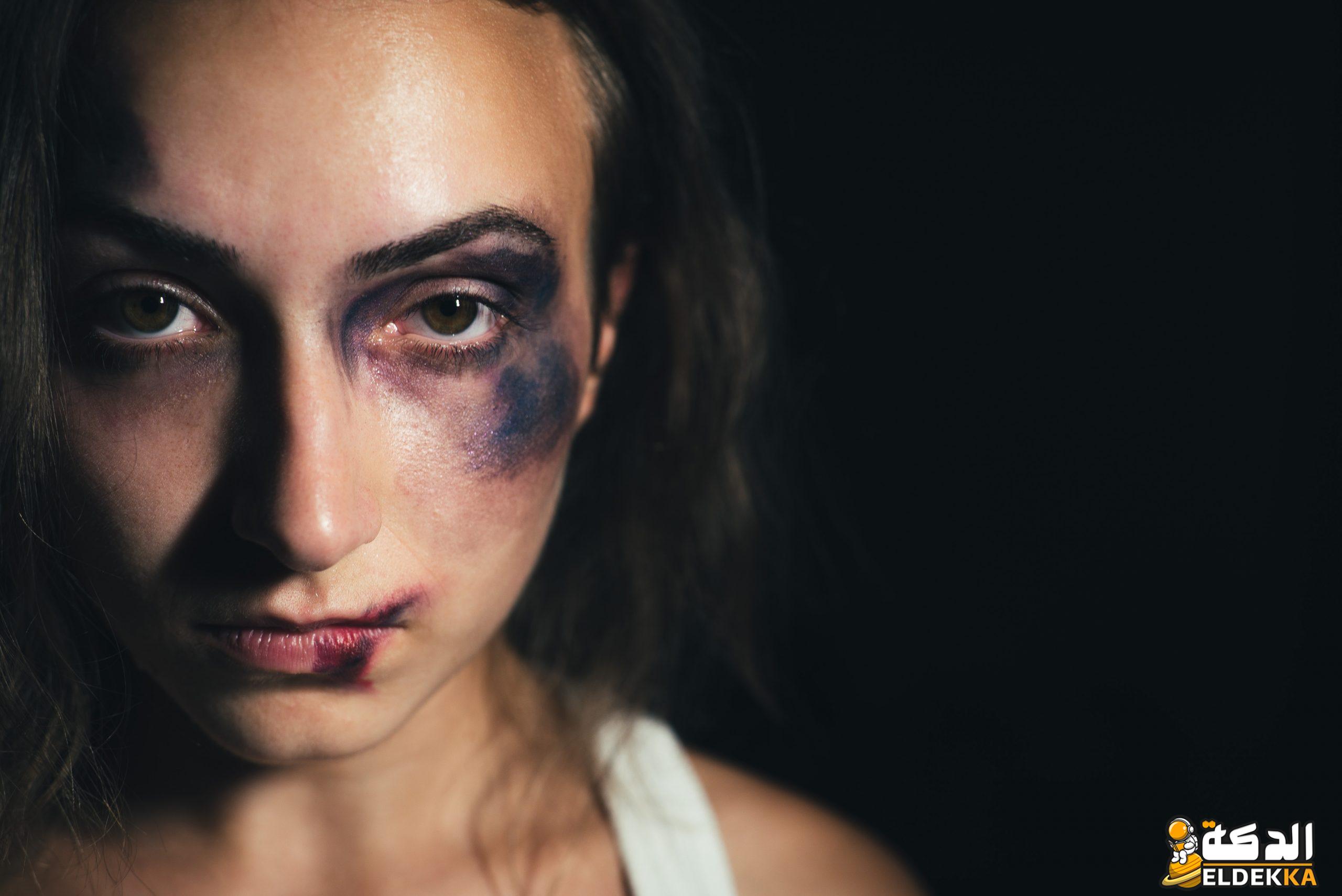 أسئلة وأجوبة عن العنف ضد المرأة 7 أسئلة وأجوبة عن العنف ضد المرأة