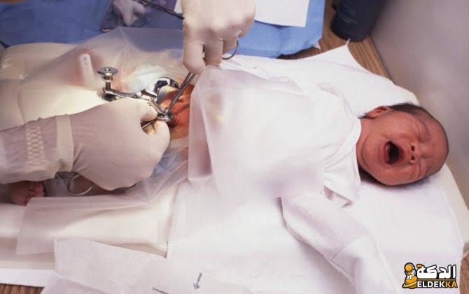 حكم ترك الختان للذكور في المذاهب الأربعة 2 حكم ترك الختان للذكور في المذاهب الأربعة