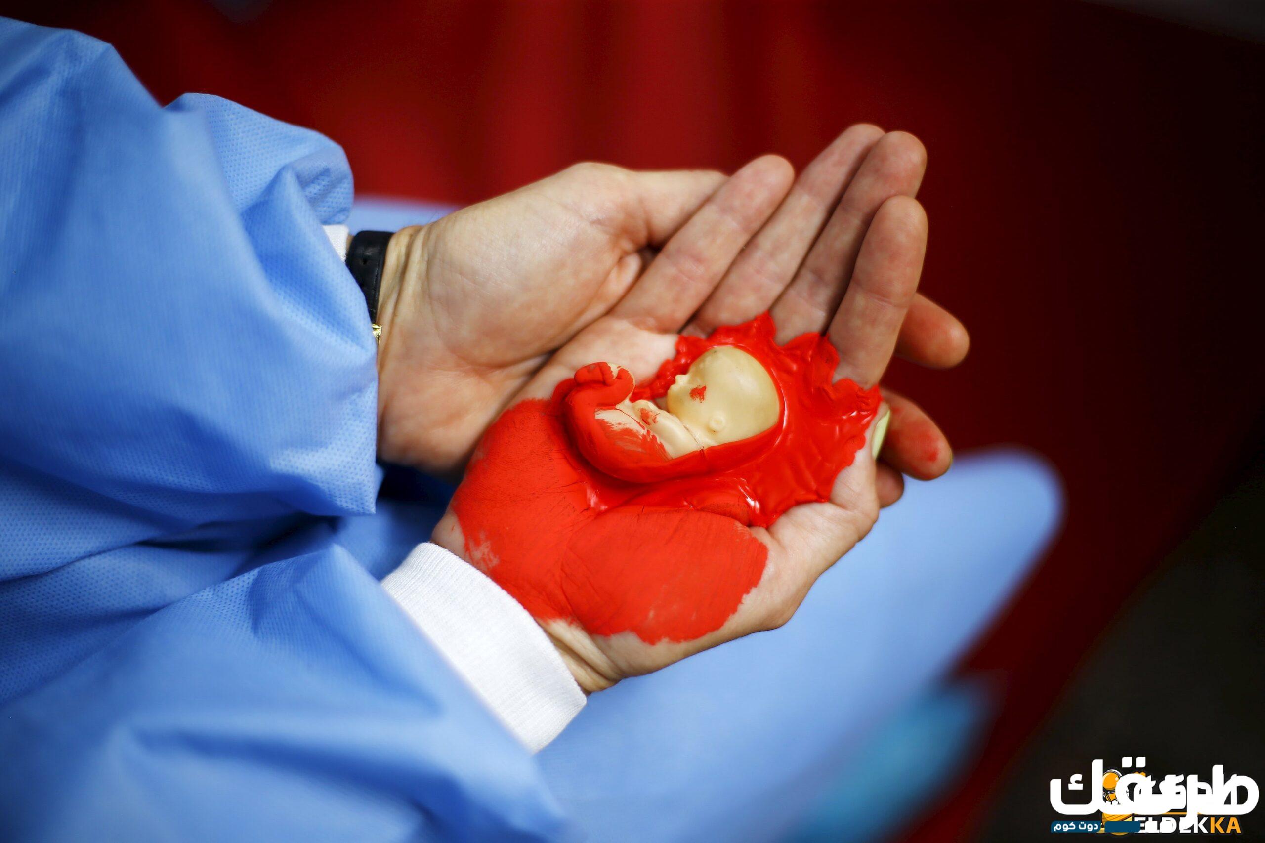 ما حكم إجهاض الجنين دون سبب؟ 3 ما حكم إجهاض الجنين دون سبب؟