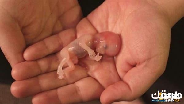 تفسير حلم الإجهاض للحامل لابن سيرين 3 تفسير حلم الإجهاض للحامل