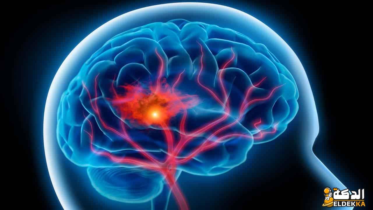 إعادة التأهيل بعد السكتة الدماغية هي مرحلة إلزامية من العلاج 4 388678164343502