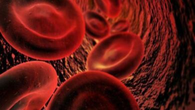 أسباب نقص الصوديوم وأعراضه وطرق علاجه 4 أسباب نقص الصوديوم وأعراضه وطرق علاجه