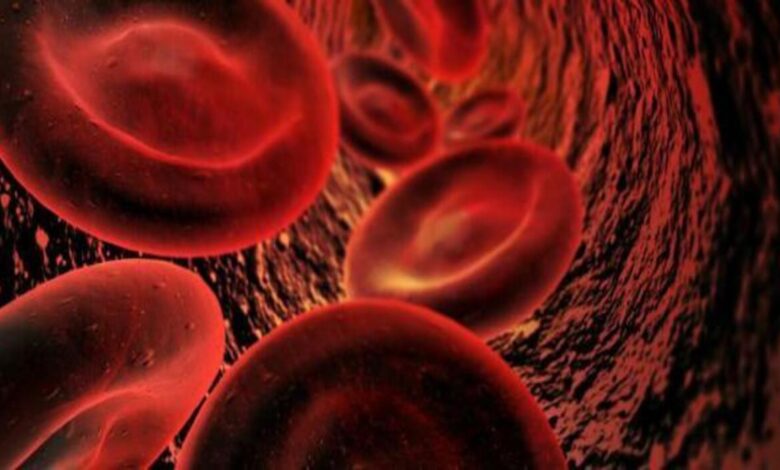 أسباب نقص الصوديوم وأعراضه وطرق علاجه 1 أسباب نقص الصوديوم وأعراضه وطرق علاجه