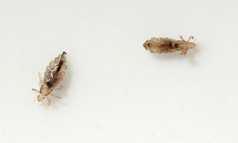 تفسير حلم القمل في الشعر وقتله 1 تفسير حلم القمل في الشعر وقتله