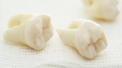 تفسير حلم سقوط سن واحد 5 تفسير حلم سقوط سن واحد