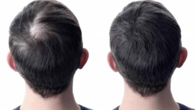كيفية حل مشكلة تساقط الشعر من المنزل 3 حل لتساقط الشعر من المنزل