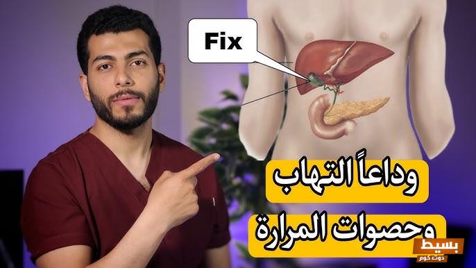 علاج حصوات المرارة في يوم واحد بإذن الله