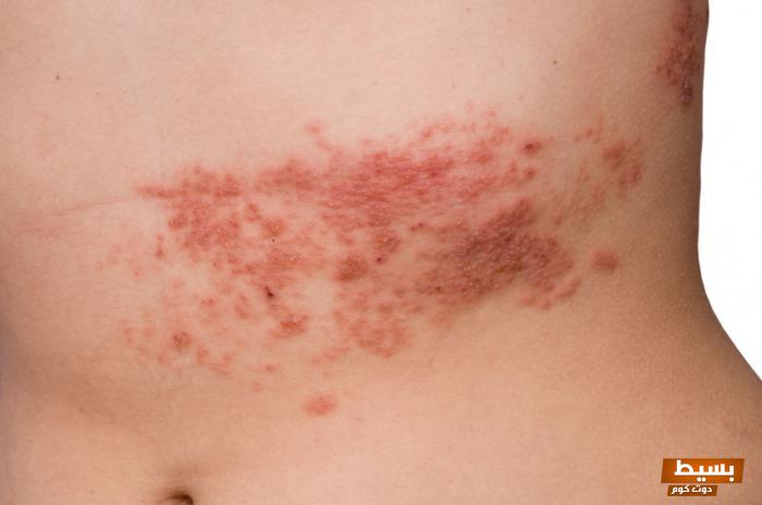 تجربتي مع الحزام الناري 6 تجربتي مع الحزام الناري