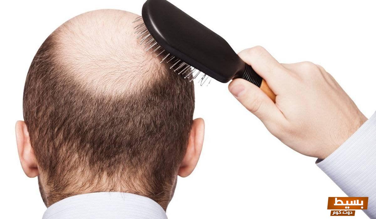 وصفة لكثافة الشعر للدكتور هاني الناظر 7 وصفة لكثافة الشعر للدكتور هاني الناظر