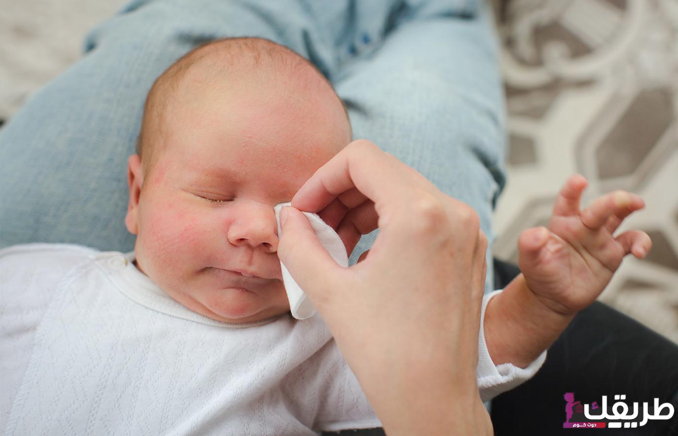 تجربتي مع انسداد القناة الدمعية وأفضل 5 طرق لعلاجها 6 203258444372457