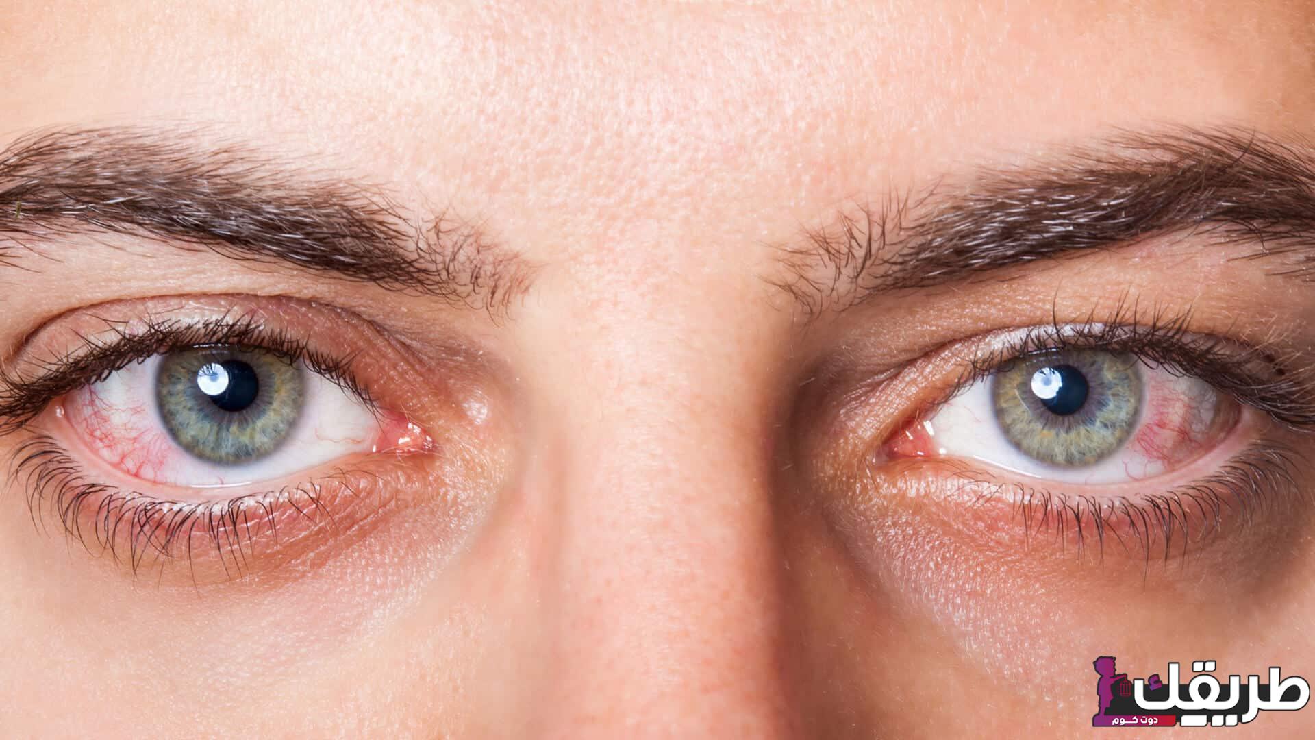 دواعى إستعمال قطرة أرتيلاك والأثار الجانبية لها 4 214913797475425