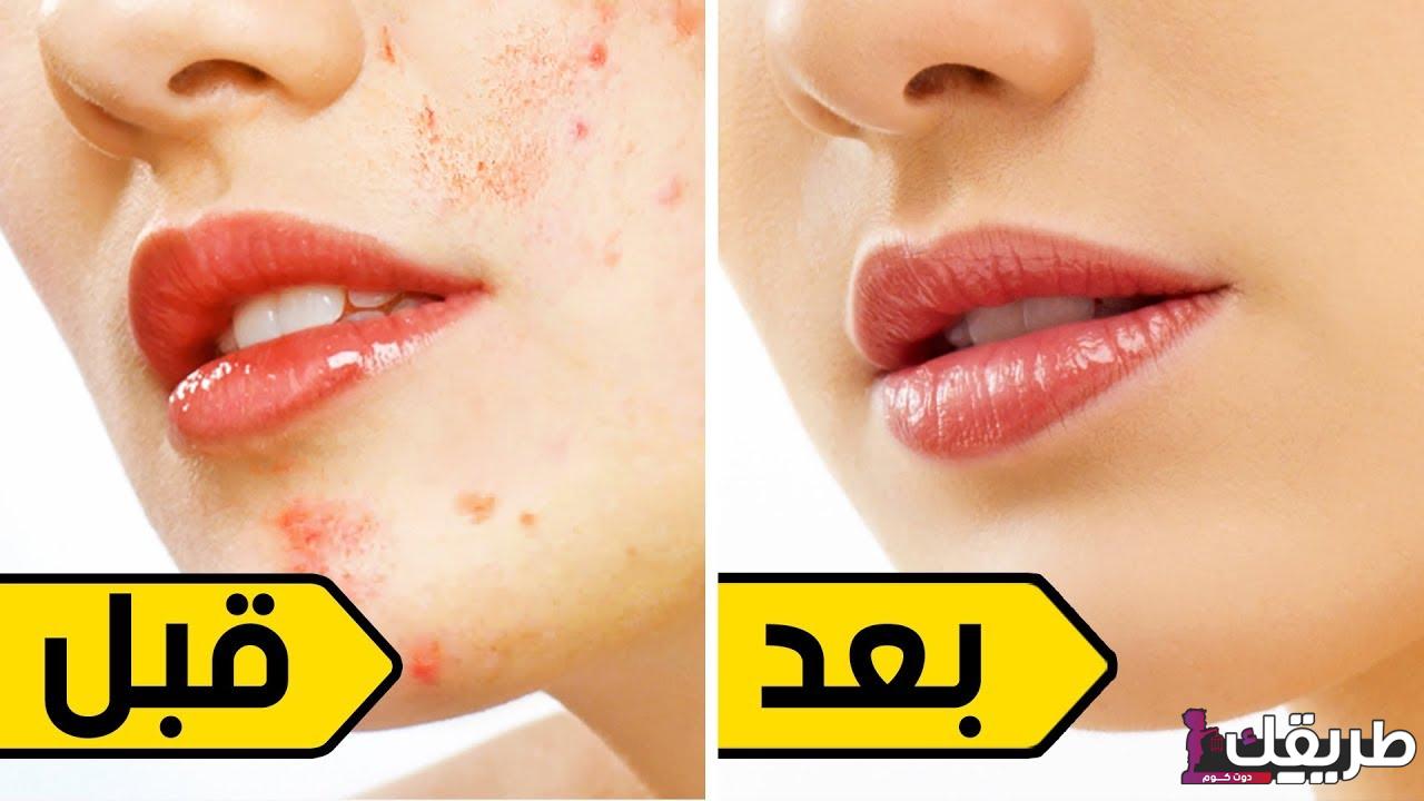 طرق ازالة البقع من الوجه في يوم بسهولة 6 32059345351895