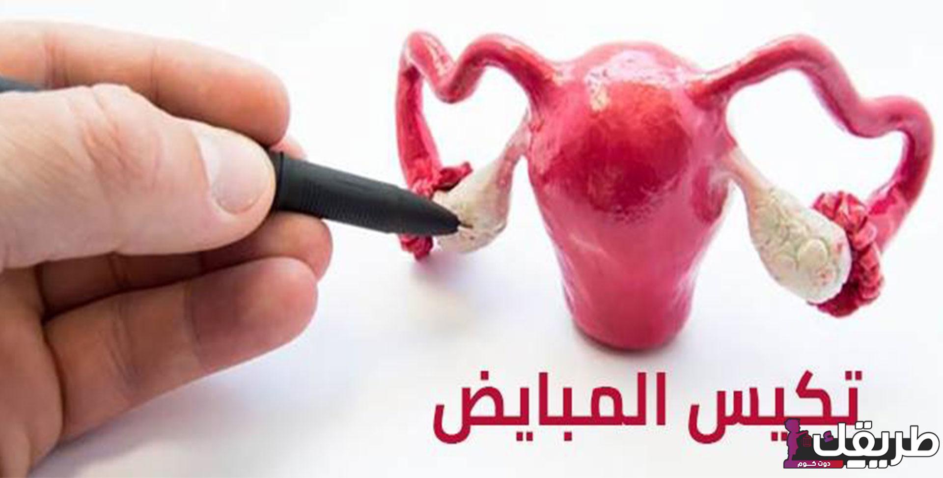 أعراض تكيس المبايض للمتزوجات تعرفي عليها الآن 2 330098500797807