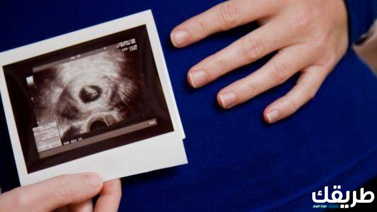 تجربتي مع الحمل بكيس بدون جنين وطريقة العلاج الصحيحة 6 35746830380703