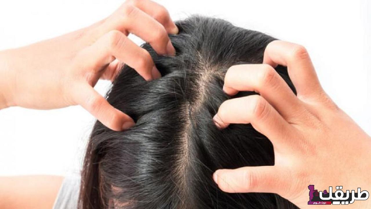 ما العلاقة بين ألم فروة الرأس وتساقط الشعر؟ 1 414478746150433