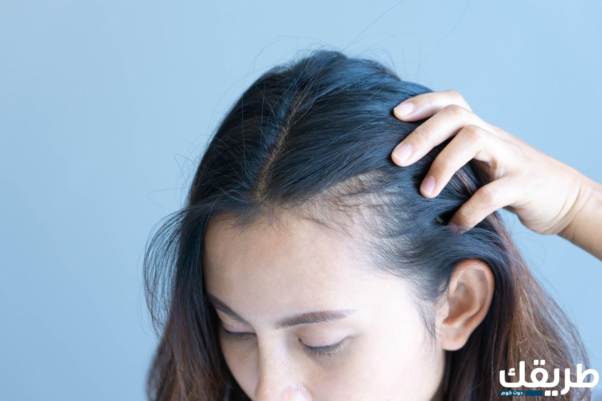 تجربتي مع الخلايا الجذعية للشعر وماهي عيوبها في عملية الزراعة 5 470643106517301