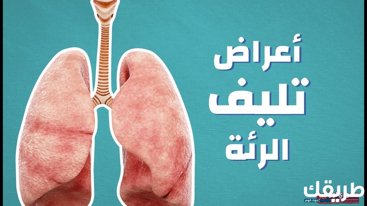 تجربتي مع تليف الرئة وطريقة الوصول إلى علاج آمن وسريع