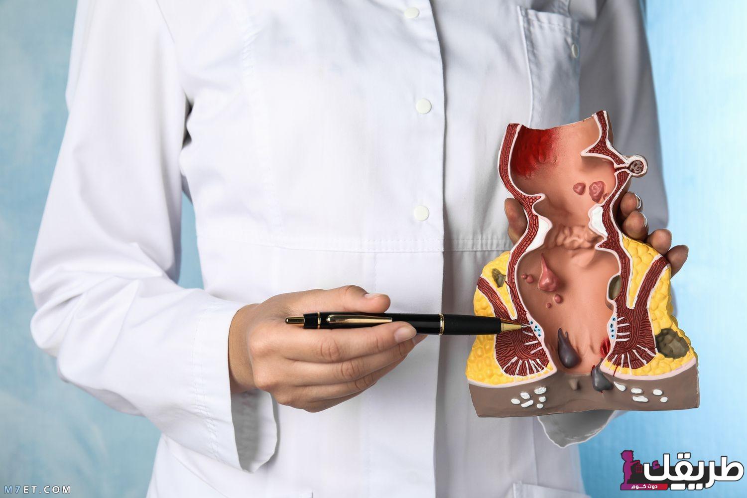 دواعى إستخدام مرهم فاكتو للبواسير والأثار الجانبية له 2 543242325279470