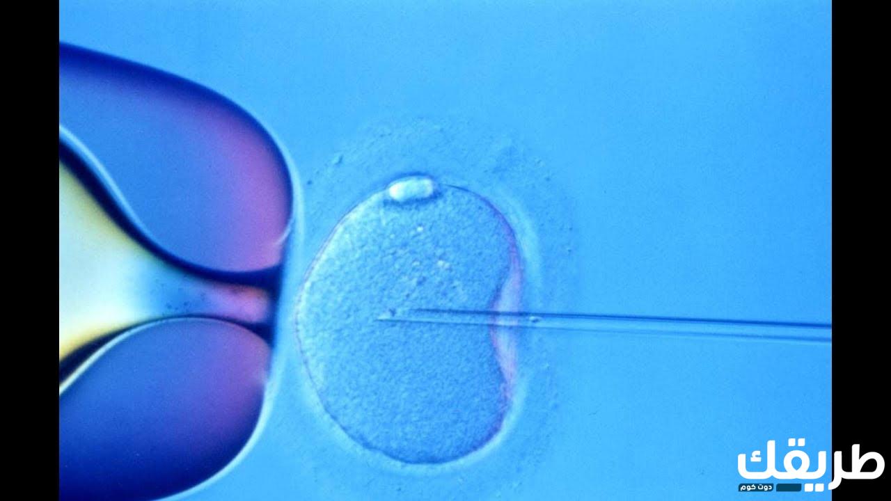 تجربتي مع عمليات الحقن المجهري وسعرها 2024 3 548261457332036