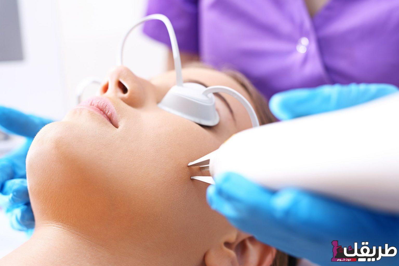 الليزر لإزالة النمش من الوجه وأبرز المزايا والأضرار والتكلفة المالية 1 564457863531703