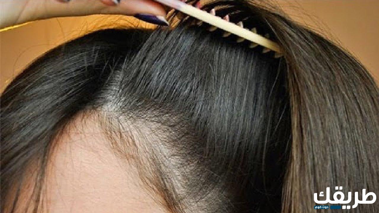 تجربتي مع حبوب فيرومن في التخلص من تساقط الشعر 4 تجربتي مع حبوب فيرومن في التخلص من تساقط الشعر