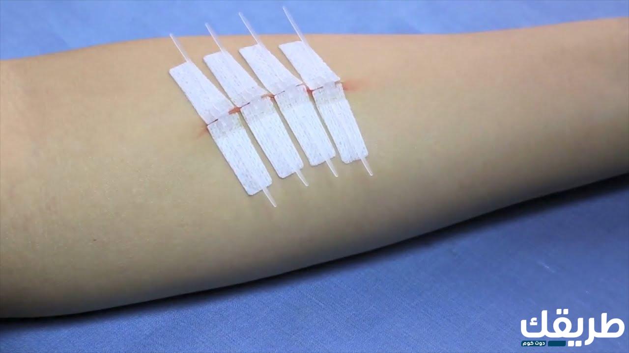 افضل مرهم للجروح السطحية ونصائح لمعالجة الجرح 1 802265294030257