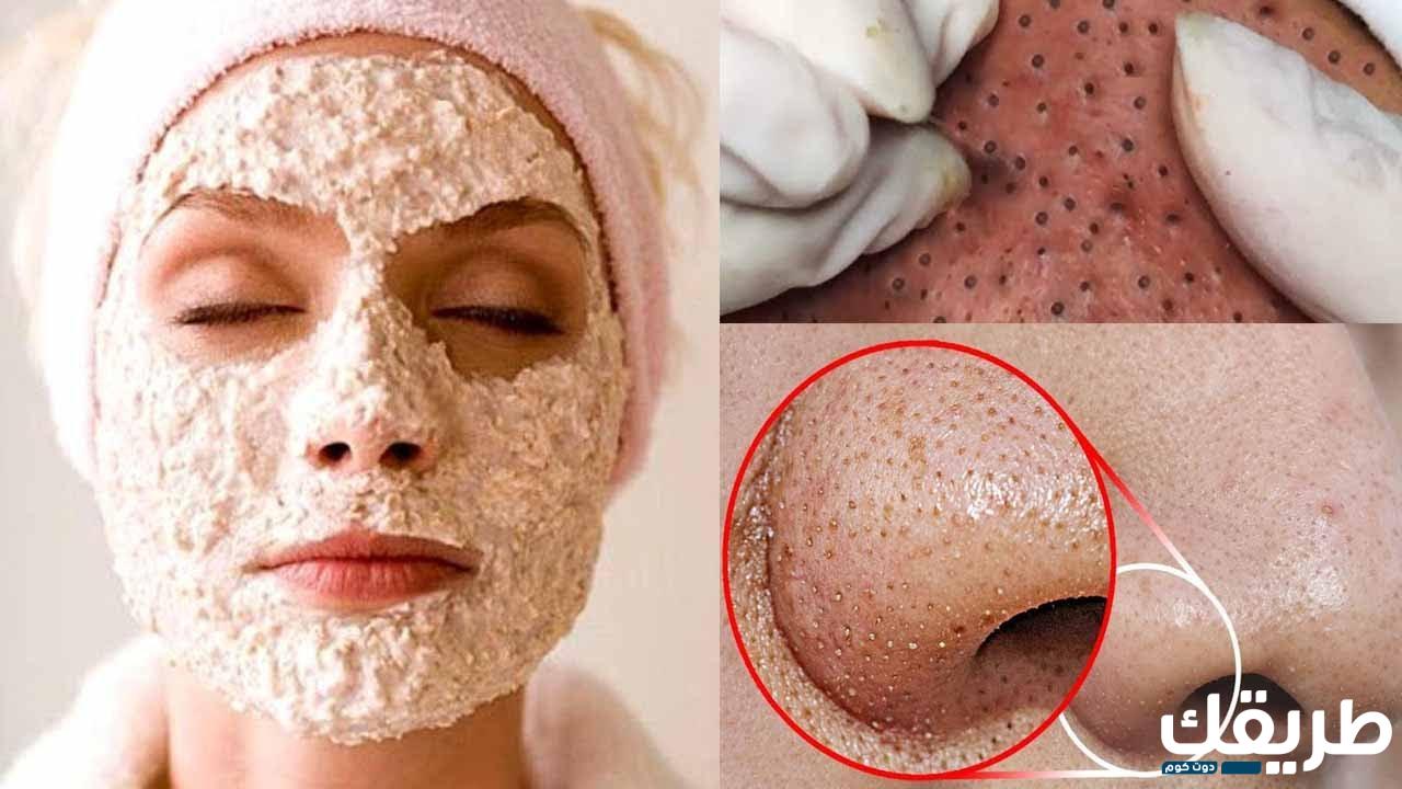 فوائد الفازلين للجسم وكيفية إستخدامه لإزالة الرؤوس السوداء 5 805428912251239