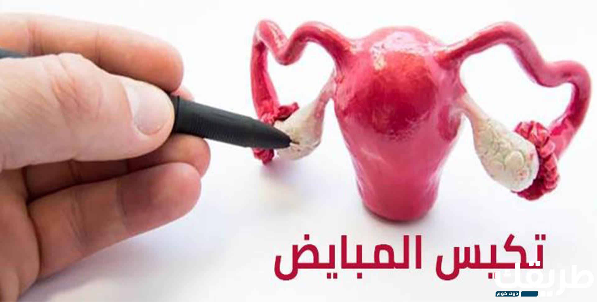 كيس علي المبيض أسباب و اعراض و تشخيص و طرق علاج بالكامل 5 998686542170947