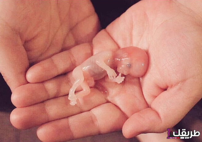 تجربتي مع الاجهاض في الشهر الثاني 6 Capture decran 2021 05 11 a 10.06.24 AM 1