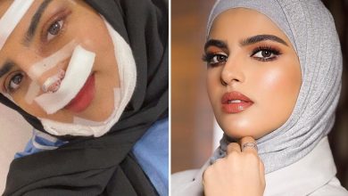 خشم سارة الودعاني ما هي تكلفة العملية 6 dr. art beauty 271407735 253198086923331 464929378843399422 n Copy