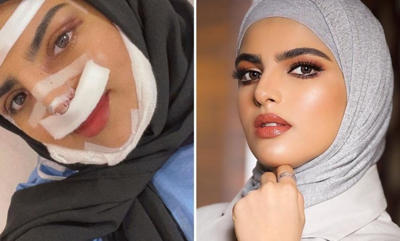 خشم سارة الودعاني ما هي تكلفة العملية 1 dr. art beauty 271407735 253198086923331 464929378843399422 n Copy