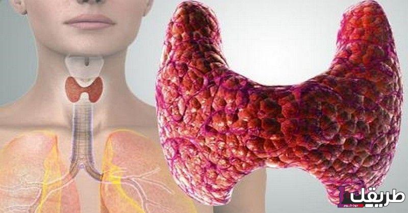 تجربتي مع اليود المشع وأهم استخداماته وأضراره 7 e89c57a3387d1c206aaba4da1021678b