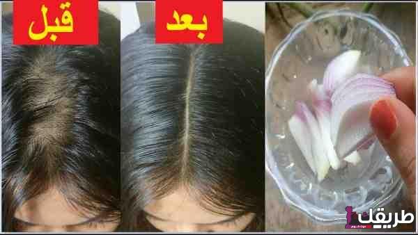 تجربتي مع البصل لانبات الشعر بدون أدوية 3 main qimg 2218a6294fdd8d0d360283fab10931a8