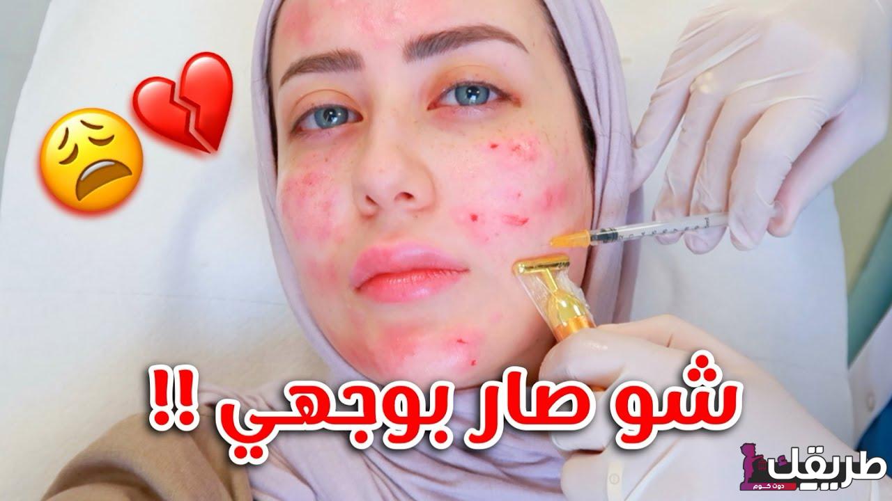 تجربتي مع ابر النضاره الرائعة وعرض لأهم فوائدها ومكوناتها 6 maxresdefault 8 1