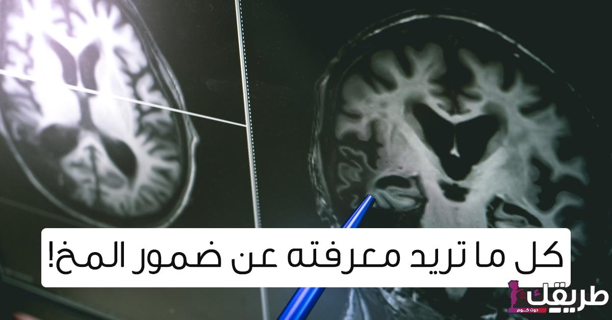تجربتي مع ضمور المخ وخطوات العلاج الصحيحة طبياً 6 tbl articles article 19752 9633ca0929a f4f6 4ef7 b064 b2272f3c3094