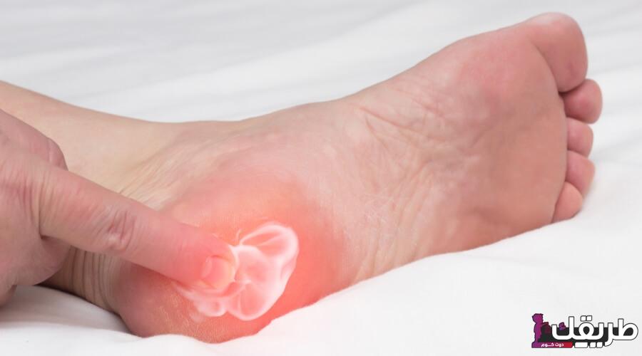 تجربتي في علاج الشوكة العظمية بوسائل طبيعية غير مكلفة 5 tbl articles article 34381 8093f26abed 8a7f 49a5 b52f 1889dbba1e53