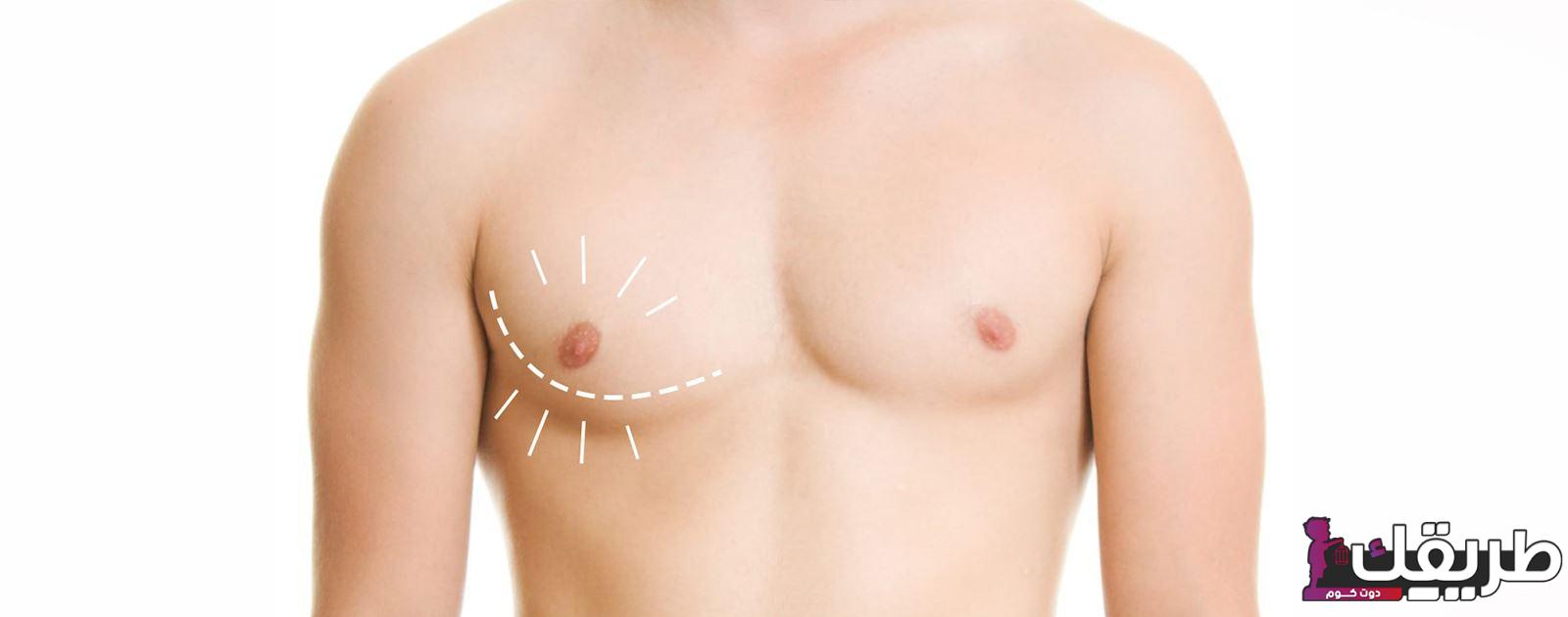 تفاصيل تكلفة عملية ازالة التثدي عند الرجال في السعوديه وأسبابها وأسعارها 7 التثدي عند الرجال