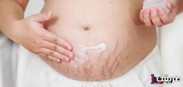 تجربتي مع الخطوط الحمراء وكيفية علاجها 4 الخطوط الحمراء بالجسم