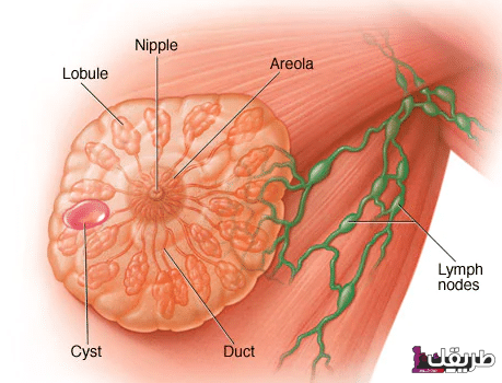 تجربتي مع الورم الليفي في الثدي وطريقة تشخيص المرض 5 ببب