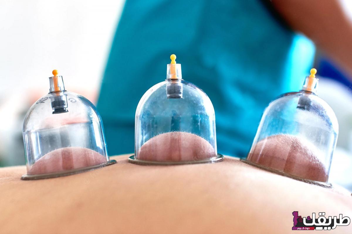 افضل مركز حجامة بالرياض للنساء وفوائد القيام بها للنساء 3 عرض الحجامه فى مستشفي السعودي الالماني الرياض