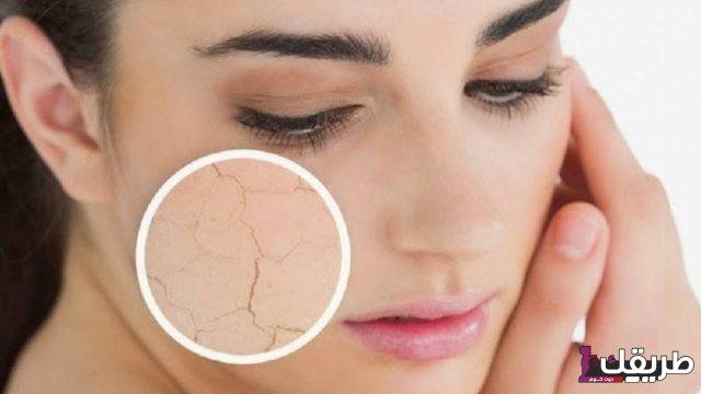 تجربتي مع علاج مسامات الوجه بالأعشاب بدون أدوية 6 علاج مسامات الوجه بالاعشاب 640x360 1