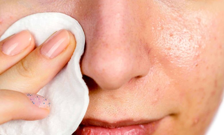 أسرع طريقة للتخلص من الرؤوس السوداء في 3 دقائق 1 16586937906226