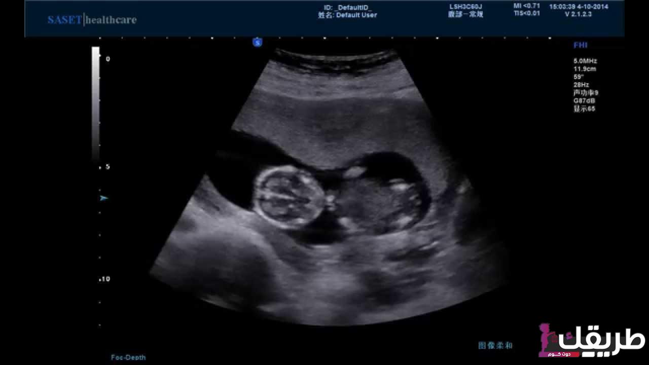 ما هو تكوين شكل الجنين في الشهر الثاني 4 288456287528972