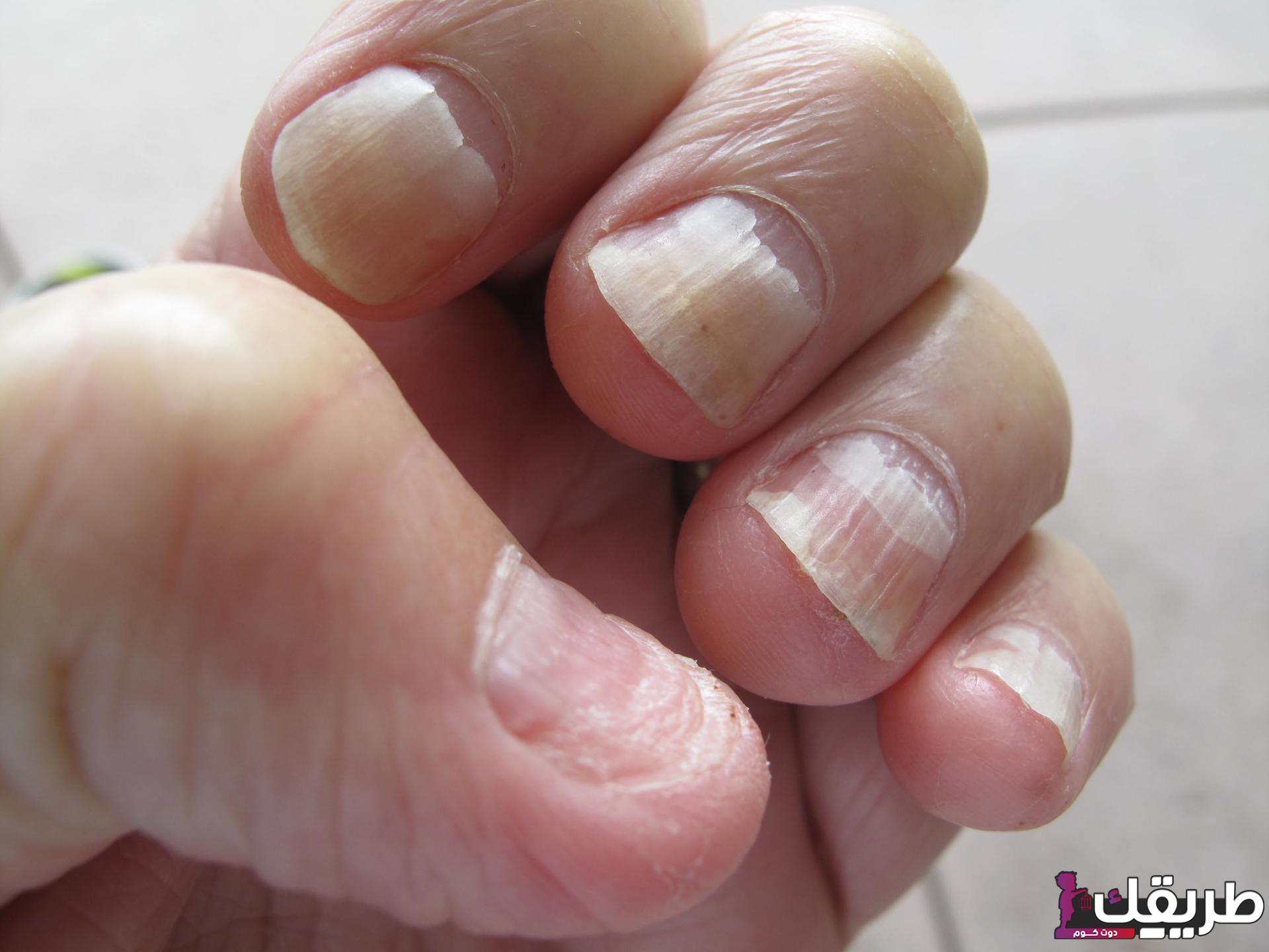 هل اكل الاظافر يفطر في رمضان وما حكم بلع الاظافر في رمضان 8 651710822729090