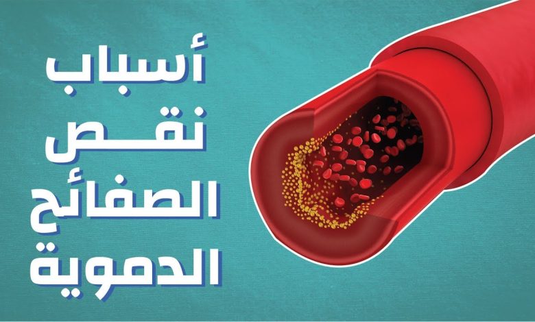 أعراض نقص الصفائح الدموية .وكيفية علاجها وأسبابها 1 981519594920963