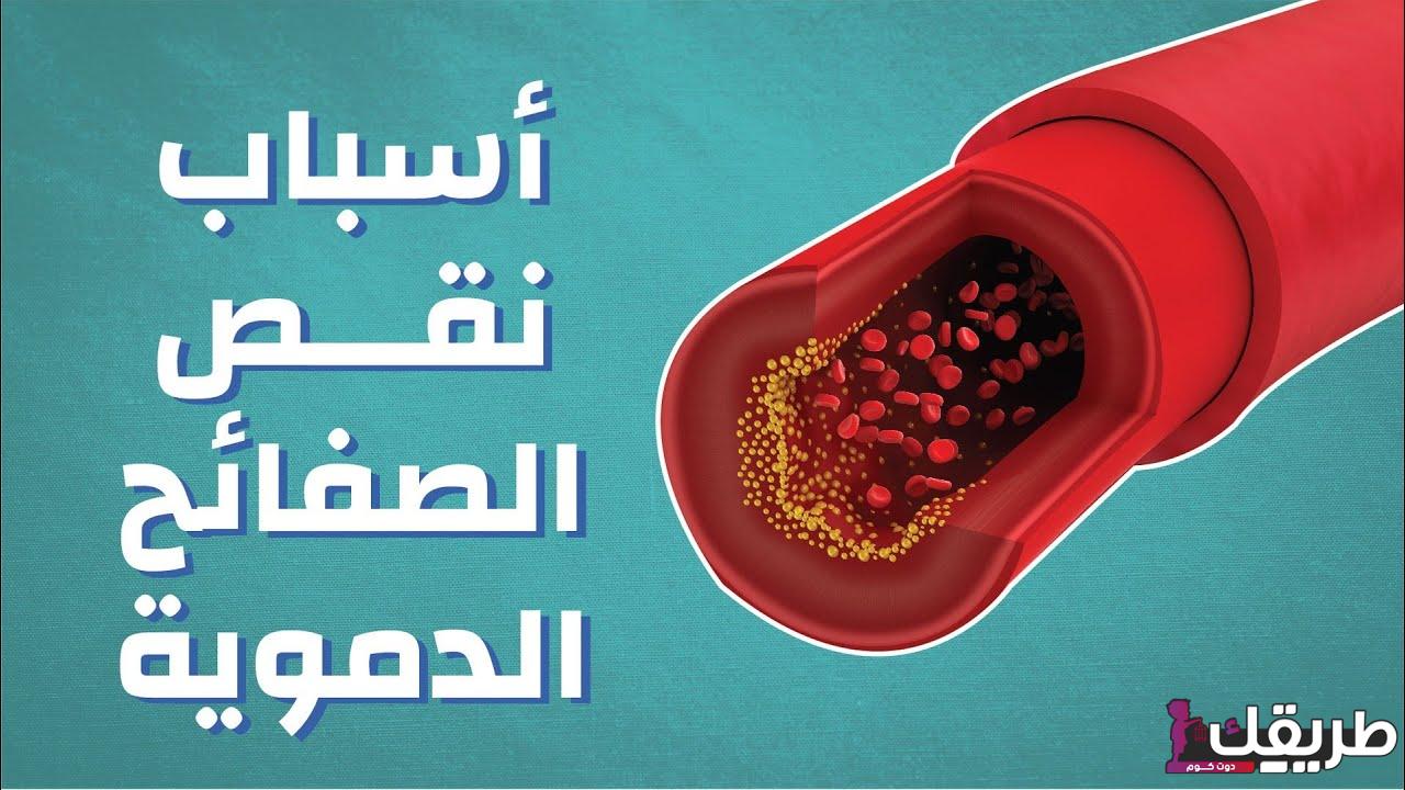 أعراض نقص الصفائح الدموية .وكيفية علاجها وأسبابها